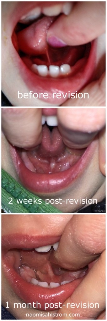 tonguetierevision.jpg
